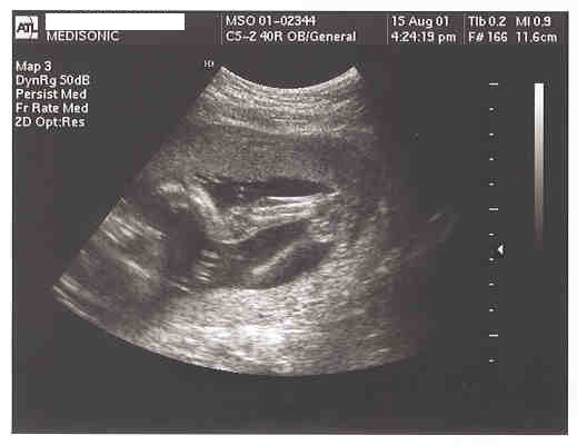 Sneak     Preview Two