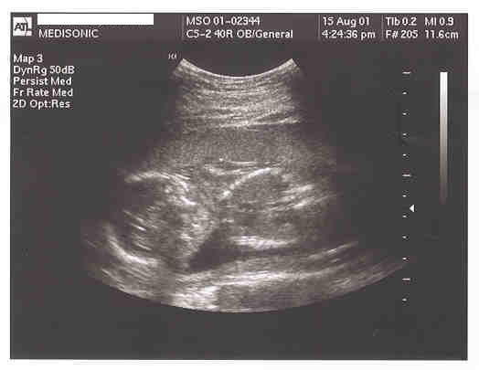 Sneak   Preview Three